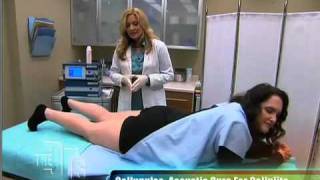 Shockwave AKA Acoustic Wave Therapy for Cellulite treatment on The Doctors [upl. by Firehs]