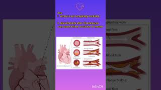 Why is Thrombolysis Contraindicated in STEMI myocardialinfarction myocarditis [upl. by Karia]