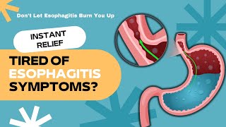 Ease Your Esophagus 5 Effective Natural Remedies for Esophagitis [upl. by Pettifer]