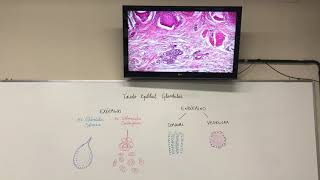 Tecido Epitelial Glandular [upl. by Inotna219]