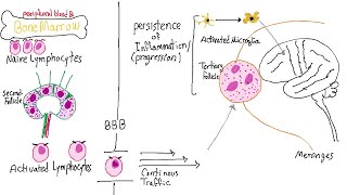 Clinical neuroimaging of Multiple Sclerosis pathology [upl. by Kcirdahs]