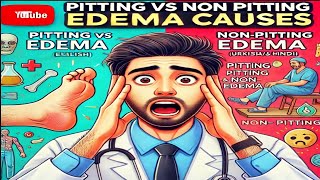 Pitting vs Non Pitting Edema Causes Surprising Facts You Didn’t Know [upl. by Adirf]