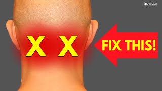 How to Instantly Relieve Neck Pain at the BASE OF THE SKULL [upl. by Bernard]