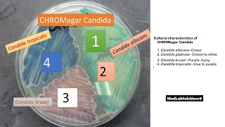 Candida albicans Candida krusei and Candida tropicalis colony morphology on Candida Chromagar [upl. by Lombardy172]