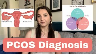 I was diagnosed with PCOS Where do I go from here [upl. by Bonina382]