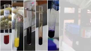 Qualitative Analysis of Amino Acids  Amrita University [upl. by Dalohcin]