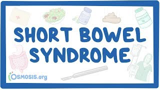 Short bowel syndrome  causes symptoms diagnosis treatment pathology [upl. by Siubhan23]