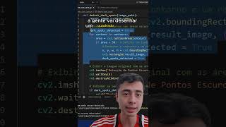 Python dicas  Detectando cáries nos dentes python programação opencv visaocomputacional tech [upl. by Rebba136]