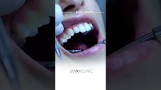 Dental Treatment in Antalya  MaxxClinic [upl. by Namlas]