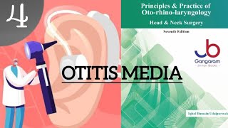 OTITIS MEDIA PART4 ENT LECTURES [upl. by Tuhn]