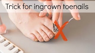 How to Fix Ingrown Toenails Easily [upl. by Cornell]