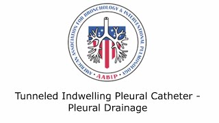 Tunneled Indwelling Pleural Catheter  Pleural Drainage [upl. by Gascony]