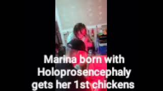 Marina born with Holoprosencephaly loves her chickens [upl. by Ardnola]