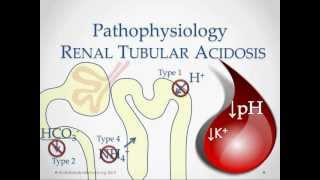 Renal Tubular Acidosis  USMLE STep 2 Review [upl. by Eirene466]