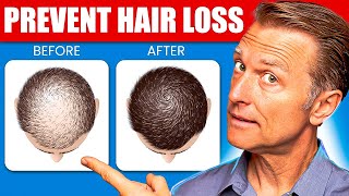 12 Proven Remedies to Prevent Hair Loss and Regrowth Regrow hair [upl. by Etnovad537]