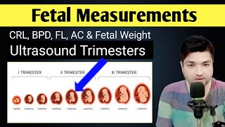 Normal Fetus Measurement in Ultrasound by Dr Ali Waqar [upl. by Kimmel]