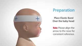 Using our Craniometer to Measure and Monitor Flat Head Syndrome [upl. by Dibbell]