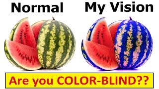 DIFFERENT TYPES of COLORBLINDNESS [upl. by Ialda]