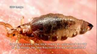 Lyme Disease amp Borrelia burgdorferi [upl. by Sapphire]