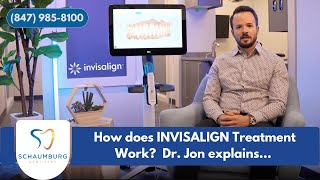 Invisalign FAQs How does Invisalign treatment work [upl. by Lahcar]