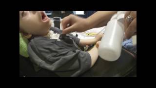 RESQVAC with a Tracheostomy Patient [upl. by Catherina767]