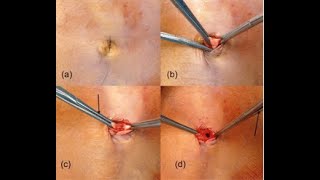 Clamping and grasping surgical instruments [upl. by Hewitt]