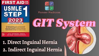 DirectIndirect Inguinal Hernias anatomy from first aid step 1part 9USMLEUrduHindi [upl. by Nonna]