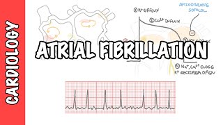 Atrial Fibrillation Overview  ECG types pathophysiology treatment complications [upl. by Siulesoj985]