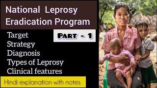 National Leprosy Eradication Program  Diagnosis amp Types of Leprosy  psm community norcet nurse [upl. by Auhel]