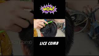 Removal Big Lice Part2 licecomb short [upl. by Martina]