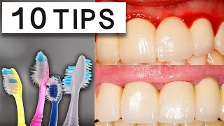 10 Tips To Reduce Swollen Gums At Home [upl. by Notsyrb]