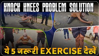 SSC GD Medical Knock Knees Problem Soution Exercises How to Cure Knock Knees  rojgarwithankit rwa [upl. by Verlie]