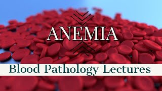 ANEMIA lecture 8 HERIDITARY SPHEROCYTOSIS in simple way [upl. by Nilek]