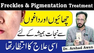 How To Treat Freckles And Face Pigmentation In Urdu [upl. by Damle218]