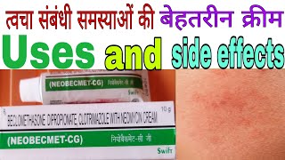 Neobecmet CG Cream Benefits and side effects in Hindi [upl. by Mailli]