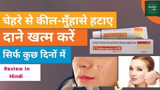 Neoclobenate Gm Cream Review in Hindi । HealthyBro। [upl. by Hathcock]