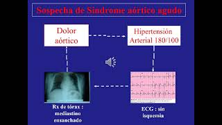 Sindrome aortico agudo Curso Superior de Emergencias  Lujan [upl. by Kenna689]