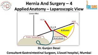 Mastering Hernia Surgery  4 Applied anatomy for Laparoscopic Inguinal hernia  Edusurg Clinics [upl. by Ecirtnuahs]