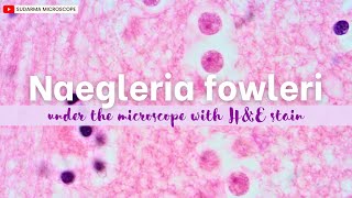 Naegleria fowleri under the microscope with Haematoxylin and Eosin HampE stain [upl. by Sylvia]