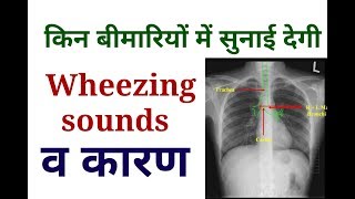 Wheezing Sounds  Causes OF wheezing Sounds  Lungs Examination [upl. by Saunders]