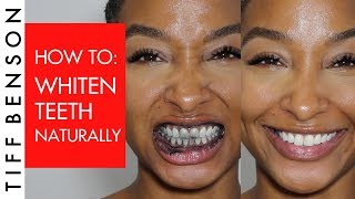 How to Whiten Teeth Naturally with Activated Charcoal [upl. by Tnilf]