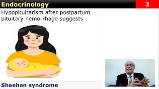 USMLE Step 2  Endocrinology 1 Flash Card Review [upl. by Irv533]