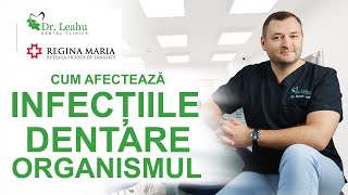 Ce impact au infecțiile dentare asupra organismului [upl. by Siocnarf70]