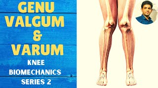 GENU VALGUM amp GENU VARUM  Knee Complex Biomechanics [upl. by Armando]