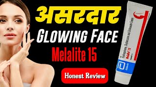 Melalite 15 Cream Review  No Side Effects Skin Whitening Cream  Hydroquinone For Skin Whitening [upl. by Enerehs]