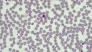 WBC Differential WBCPLT Estimate RBC Morphology [upl. by Naji]