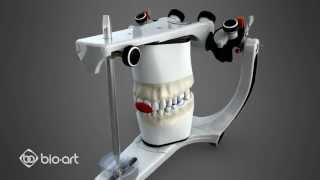 Diagnosis in articulator [upl. by Mode979]