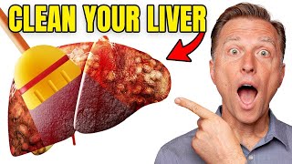 Top BEST Foods to Clean Out Your Liver [upl. by Akel]