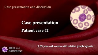 Patient case presentation case 2 [upl. by Nilsoj325]