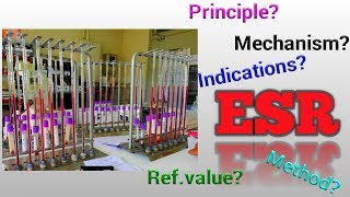 ESR TestEsrErythrocyte Sedimentation RateHematologyESR testESR normal rangeSTAR LABORATORY [upl. by Sholley]